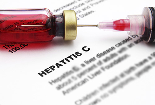 Hepatitis C Screening Package