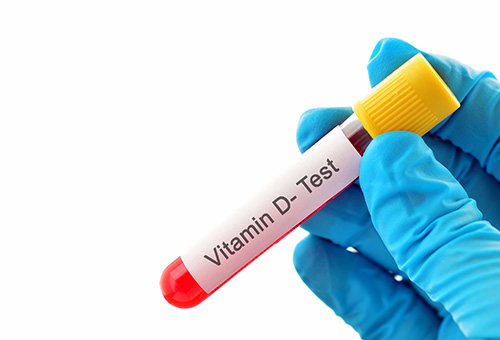 Vitamin D Package